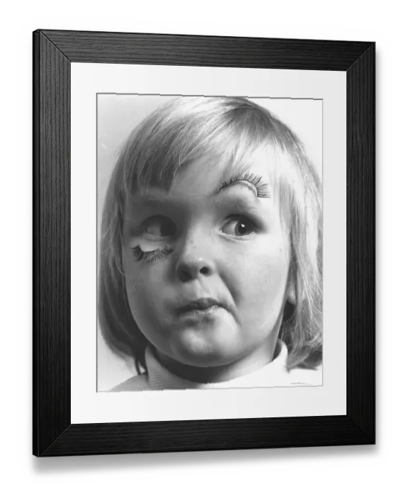 Framed Print : Girl with false eyelash, England, Great Britain