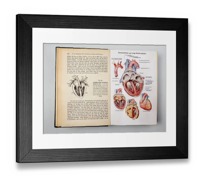 Framed Print : Heart diseases, illustrations from the book Dr