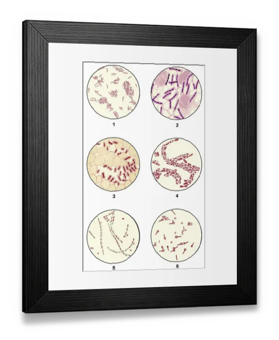 Framed Print : Bacteria smears of germs for microbiological diagnosis