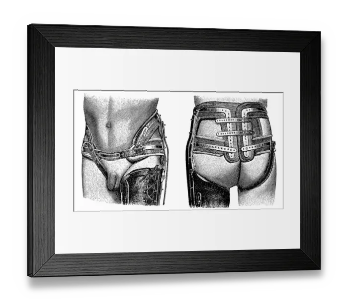 Framed Print : Pelvic girdle, brace, state of the art of therapeutic techniques Framed Print : Pelvic girdle, brace, state of the art of therapeutic techniques