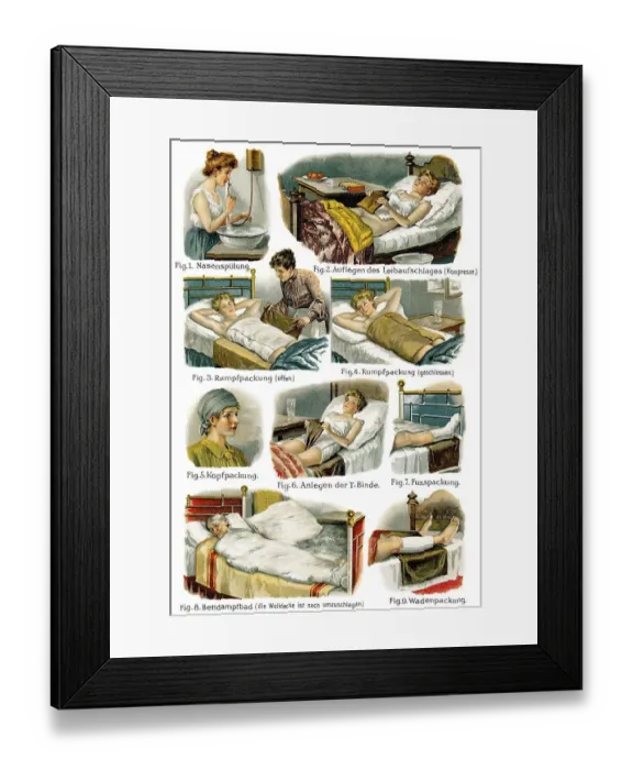 Framed Print : Medical bandaging, 19th Century health guide illustration Framed Print : Medical bandaging, 19th Century health guide illustration