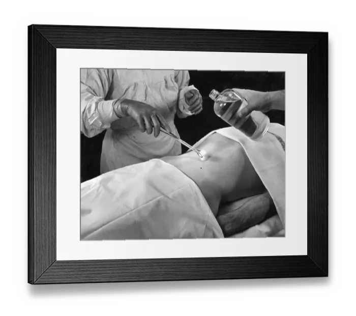 Framed Print : Medicine, health, operation on the stomach