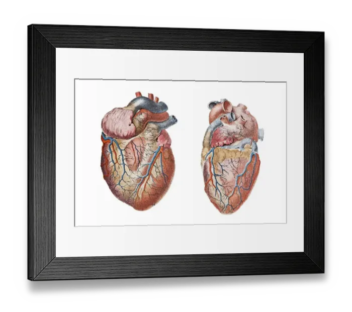 Framed Print : Human heart, anatomical illustration
