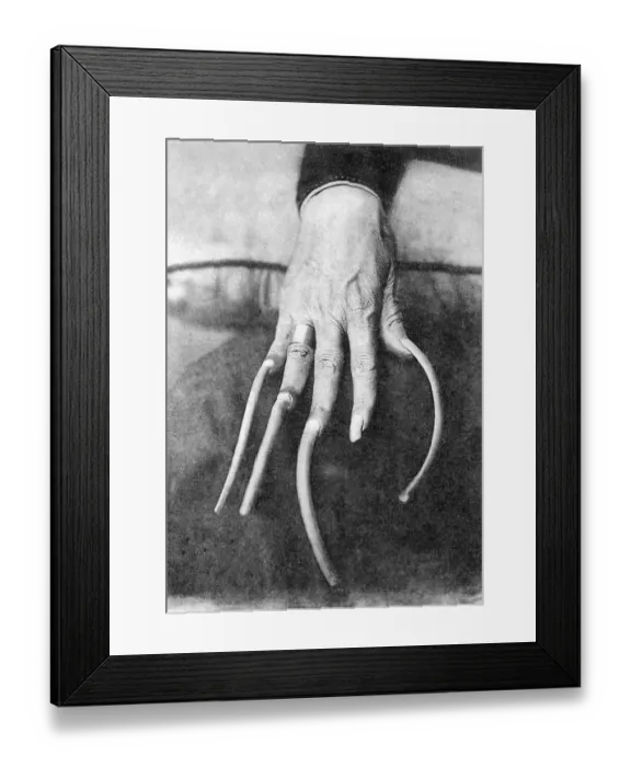 Framed Print : Historic photo, long fingernails