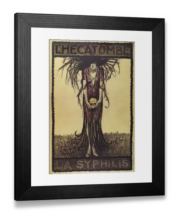 Framed Print : La syphilis L'Hecatombe