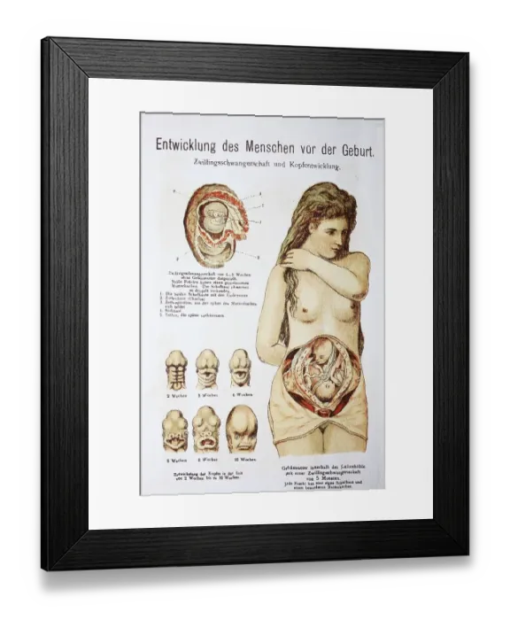 Framed Print : Human pre-birth development in woman