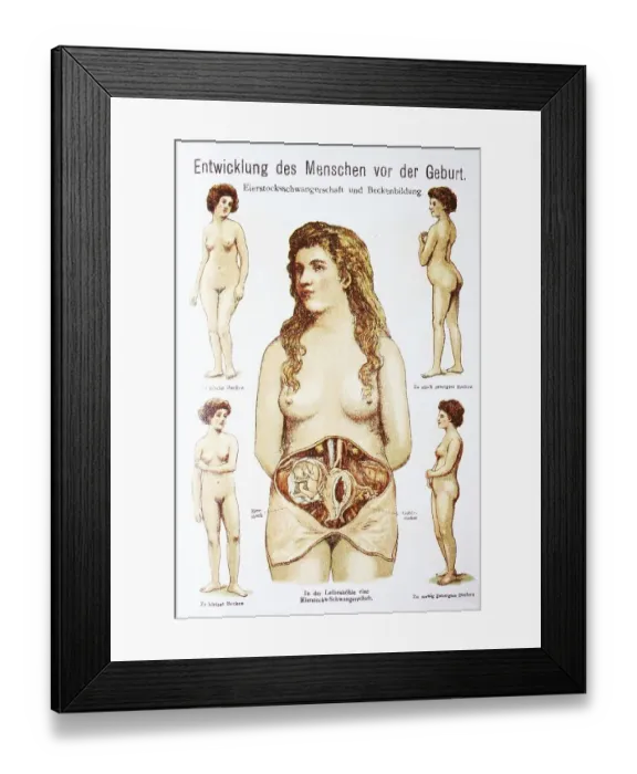 Framed Print : Human pre-birth development in woman Framed Print : Human pre-birth development in woman