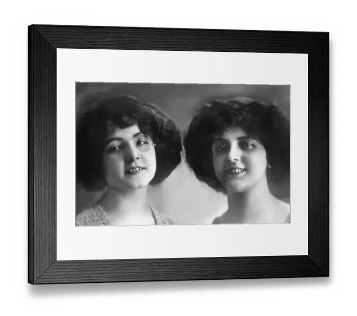 Framed Print : Sisters, twins with monocle, 1910s Framed Print : Sisters, twins with monocle, 1910s