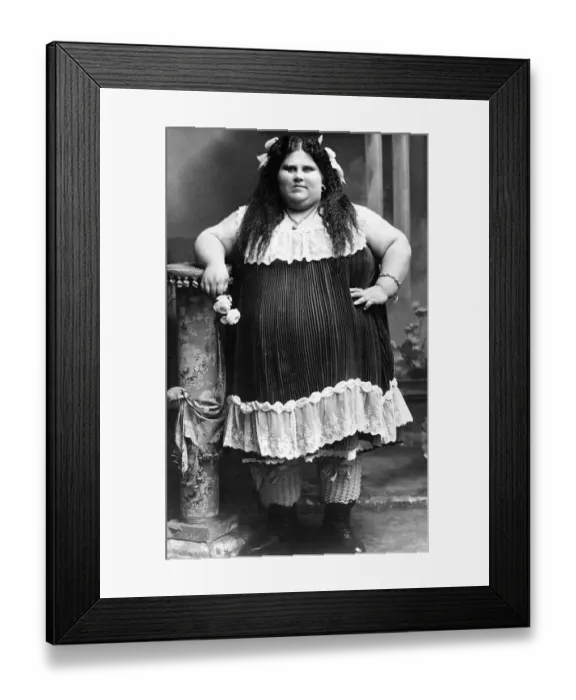 Framed Print : Historical photo, obese woman, ca. 1915