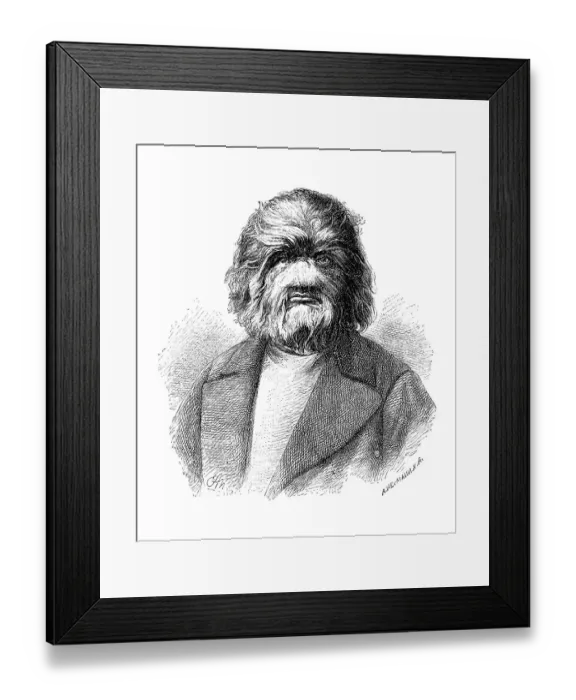 Framed Print : Adrian Yeftichev. A Russian man suffering from hypertrichosis Framed Print : Adrian Yeftichev. A Russian man suffering from hypertrichosis