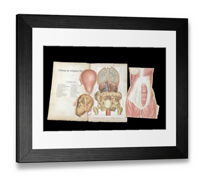 Framed Print : Dismountable model of a female body Framed Print : Dismountable model of a female body