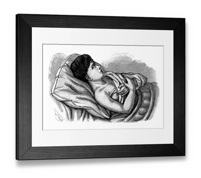 Framed Print : Measuring body temperature, historical illustration