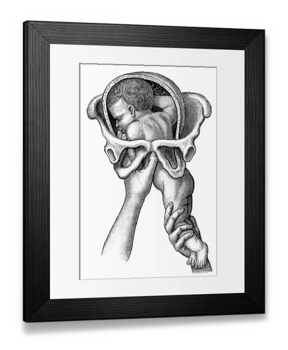 Framed Print : Birth, historical illustration from: Anna Fischer Dueckelmann