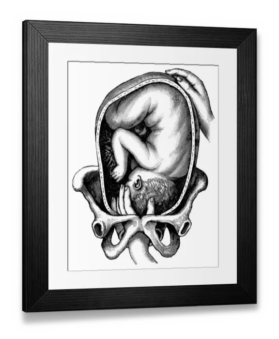 Framed Print : Birth, historical illustration from: Anna Fischer Dueckelmann