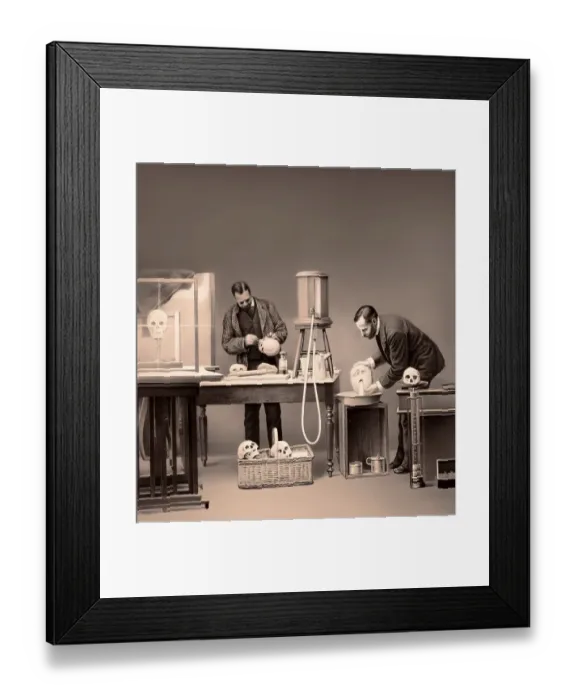 Framed Print : Ascertaining capacity of cranial cavity by means of water Framed Print : Ascertaining capacity of cranial cavity by means of water