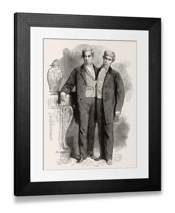 Framed Print : Chang and Eng Bunker, 1811-1874 Framed Print : Chang and Eng Bunker, 1811-1874