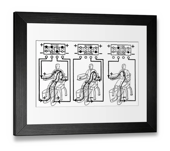 Framed Print : An illustration of a patient being treated with a four cell Schnee Bath