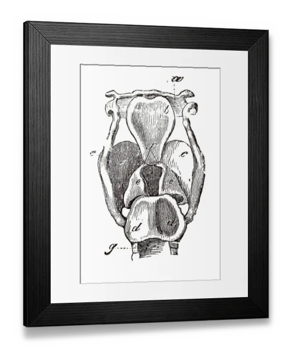 Framed Print : Larynx, anatomical illustration Framed Print : Larynx, anatomical illustration