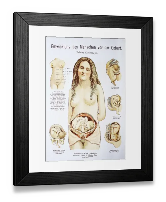 Framed Print : Human pre-birth development in woman Framed Print : Human pre-birth development in woman