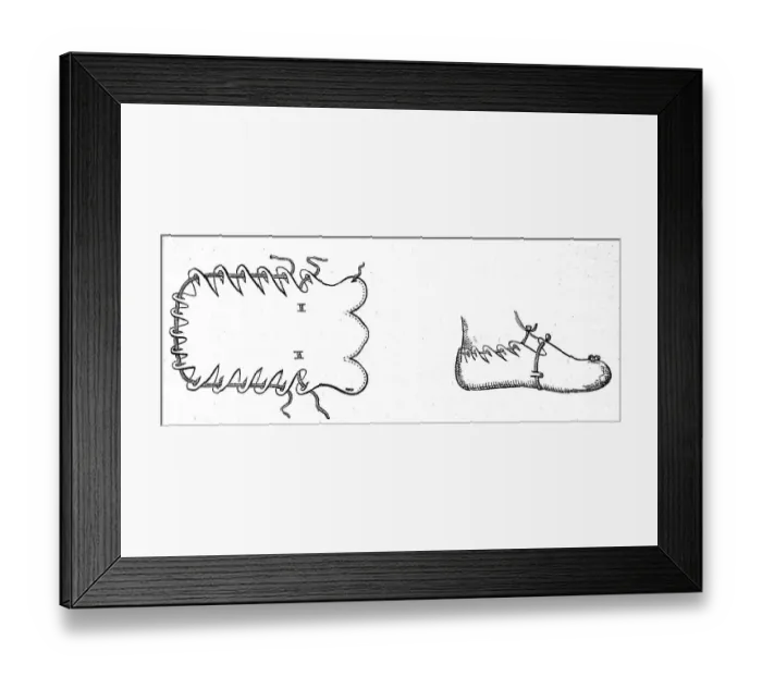 Framed Print : Bundschuh, historical leather shoe tied with a long strap Framed Print : Bundschuh, historical leather shoe tied with a long strap