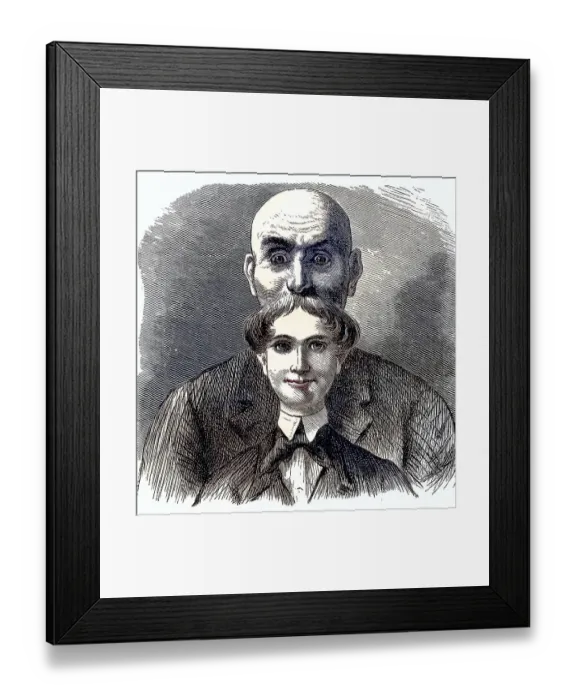 Framed Print : Hair growth in youth and old age Framed Print : Hair growth in youth and old age