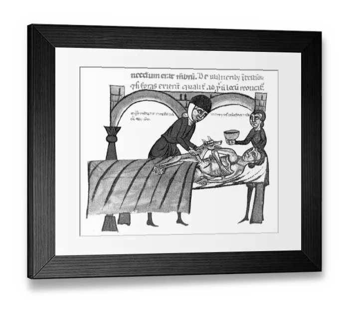 Framed Print : Medicine, Anatomy, Surgical Scene from 1300