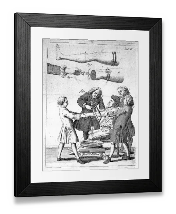 Framed Print : Medicine, Anatomy, Surgery, The Elements of Surgery