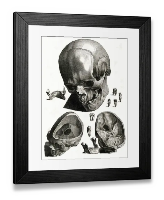 Framed Print : Medicine, Anatomy, Human skull Framed Print : Medicine, Anatomy, Human skull