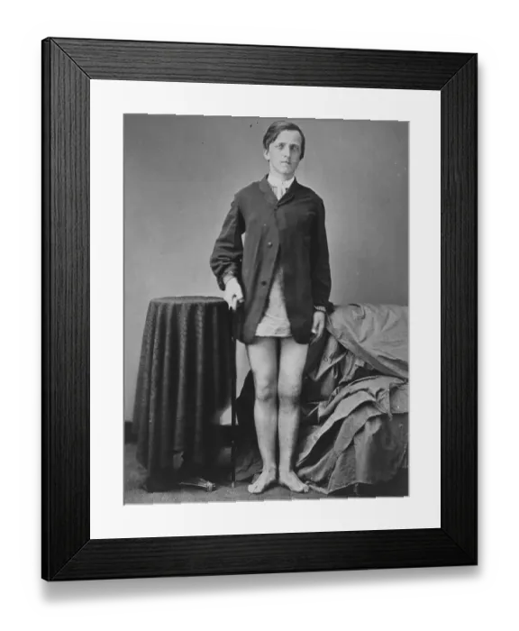 Framed Print : War-wounded Private G. W. Warrington