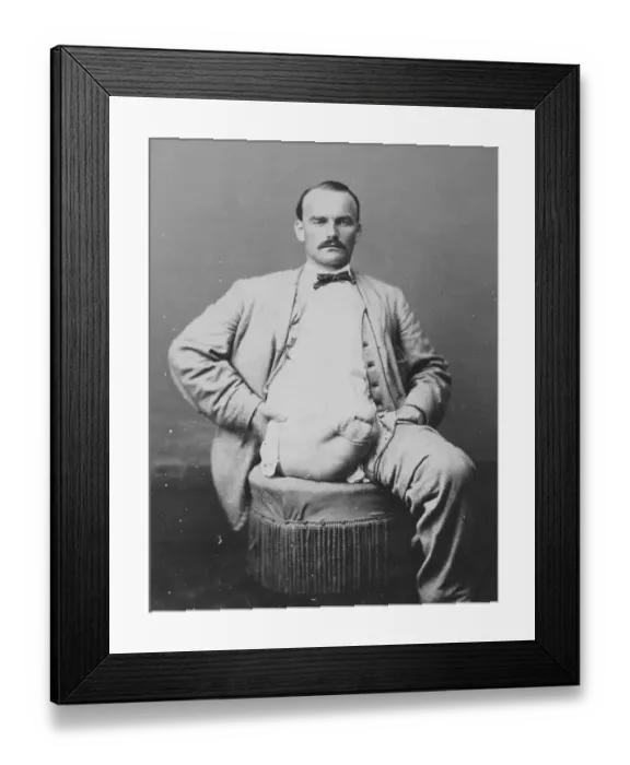 Framed Print : War-wounded Private Charles Myer
