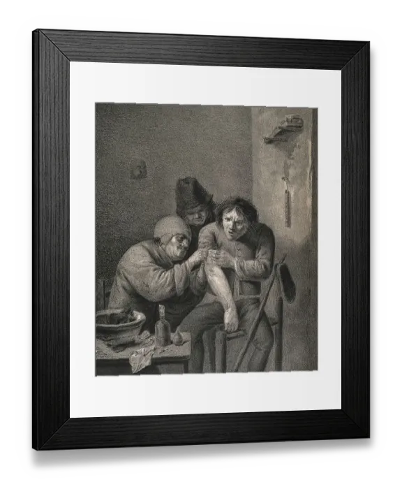 Framed Print : A surgeon dresses the wound of a grimacing patient