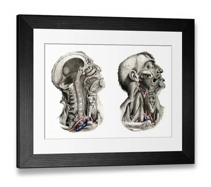 Framed Print : Medicine, human anatomy, dissection of head and neck Framed Print : Medicine, human anatomy, dissection of head and neck