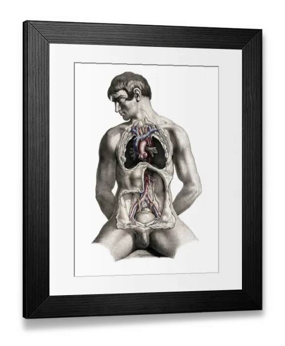 Framed Print : Medicine, human anatomy, dissection of the torso of a seated white man Framed Print : Medicine, human anatomy, dissection of the torso of a seated white man