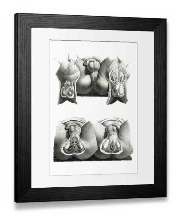 Framed Print : Medicine, human anatomy, dissection of anus