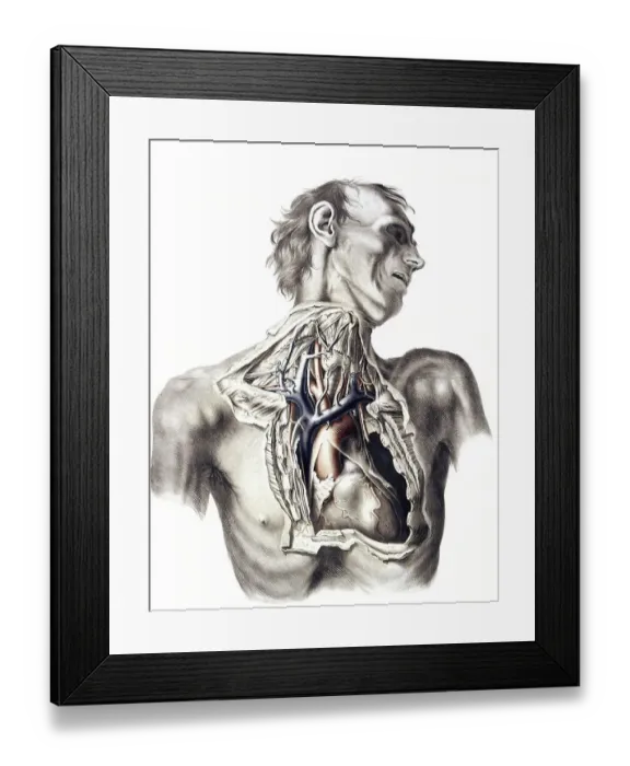 Framed Print : Medicine, human anatomy, The great arteries of the thorax and neck