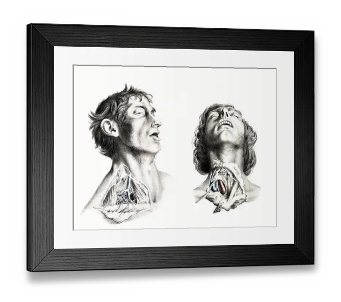 Framed Print : Medicine, human anatomy, the circulatory system