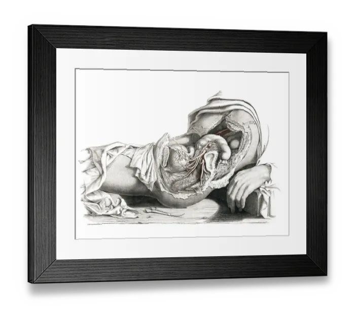 Framed Print : Medicine, human anatomy, the circulatory system Framed Print : Medicine, human anatomy, the circulatory system