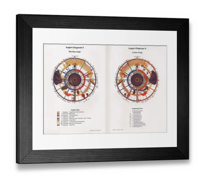 Framed Print : Iridology, alternative medicine, c