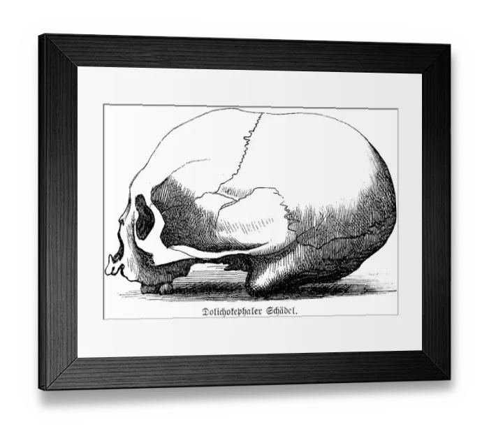 Framed Print : Dolichocephalic skull, long head with flat forehead and pronounced occiput, side view, skullcap, anthropology, archaeology, history of mankind, historical illustration 1880