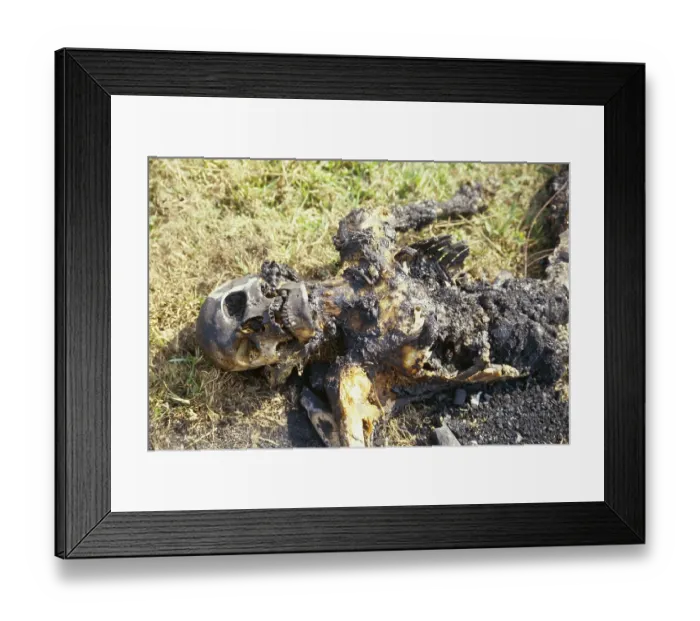 Framed Print : Burned skeleton, Cyclone in Orissa, India November 1999