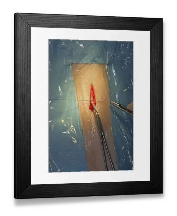 Framed Print : Castration of a cat, vet, Persian cat