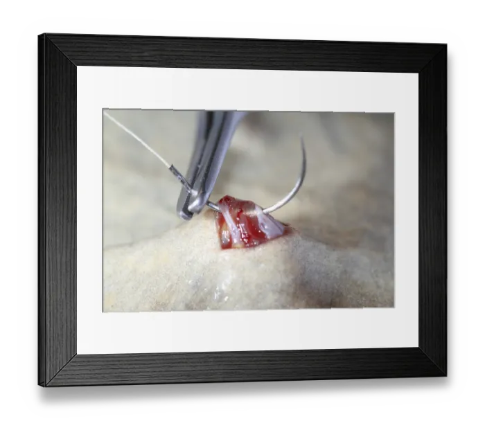 Framed Print : Smooth clawed frog, preparation of the oocytes (Xenopus laevis)