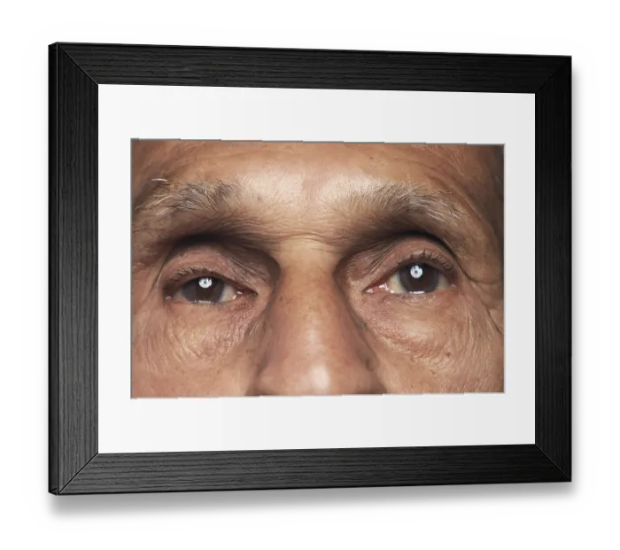 Framed Print : Human body old man eyes, India Framed Print : Human body old man eyes, India