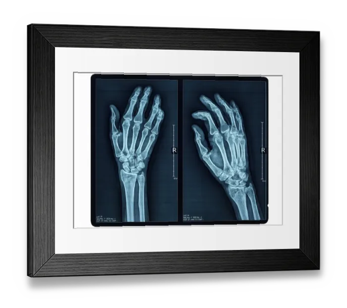 Framed Print : Hand X-ray of an adult female