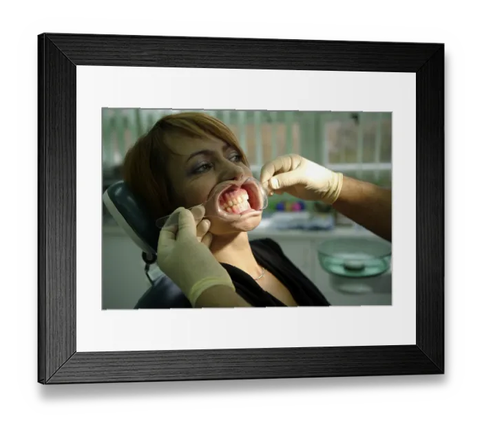 Framed Print : Woman, 39 years, dental examination Framed Print : Woman, 39 years, dental examination