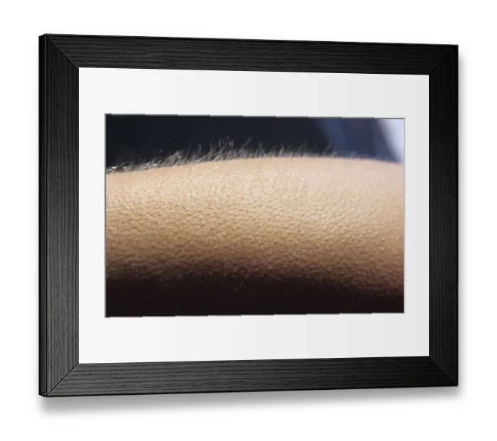 Framed Print : Close-up shot, goosebumps