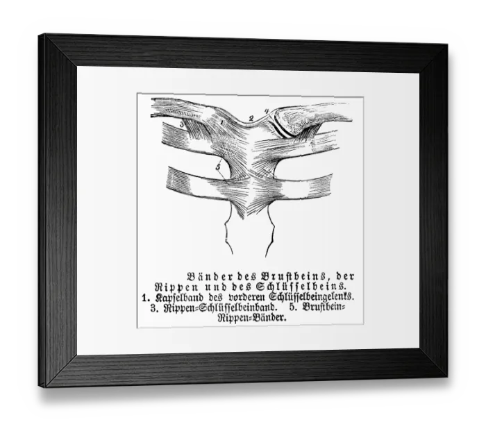 Framed Print : Sternum, ribs, collarbone, tendons Framed Print : Sternum, ribs, collarbone, tendons