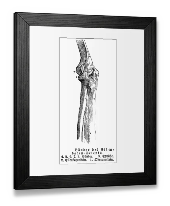 Framed Print : Elbow joint, tendons, human, body part Framed Print : Elbow joint, tendons, human, body part