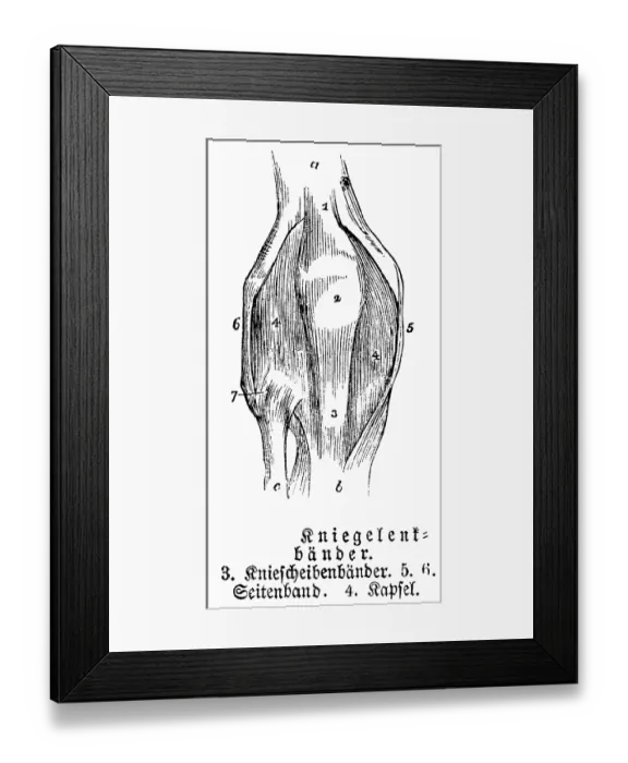 Framed Print : Knee joint, tendons, collateral ligament Framed Print : Knee joint, tendons, collateral ligament