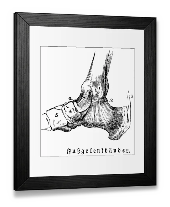 Framed Print : Tendons of the ankles, man, body part Framed Print : Tendons of the ankles, man, body part